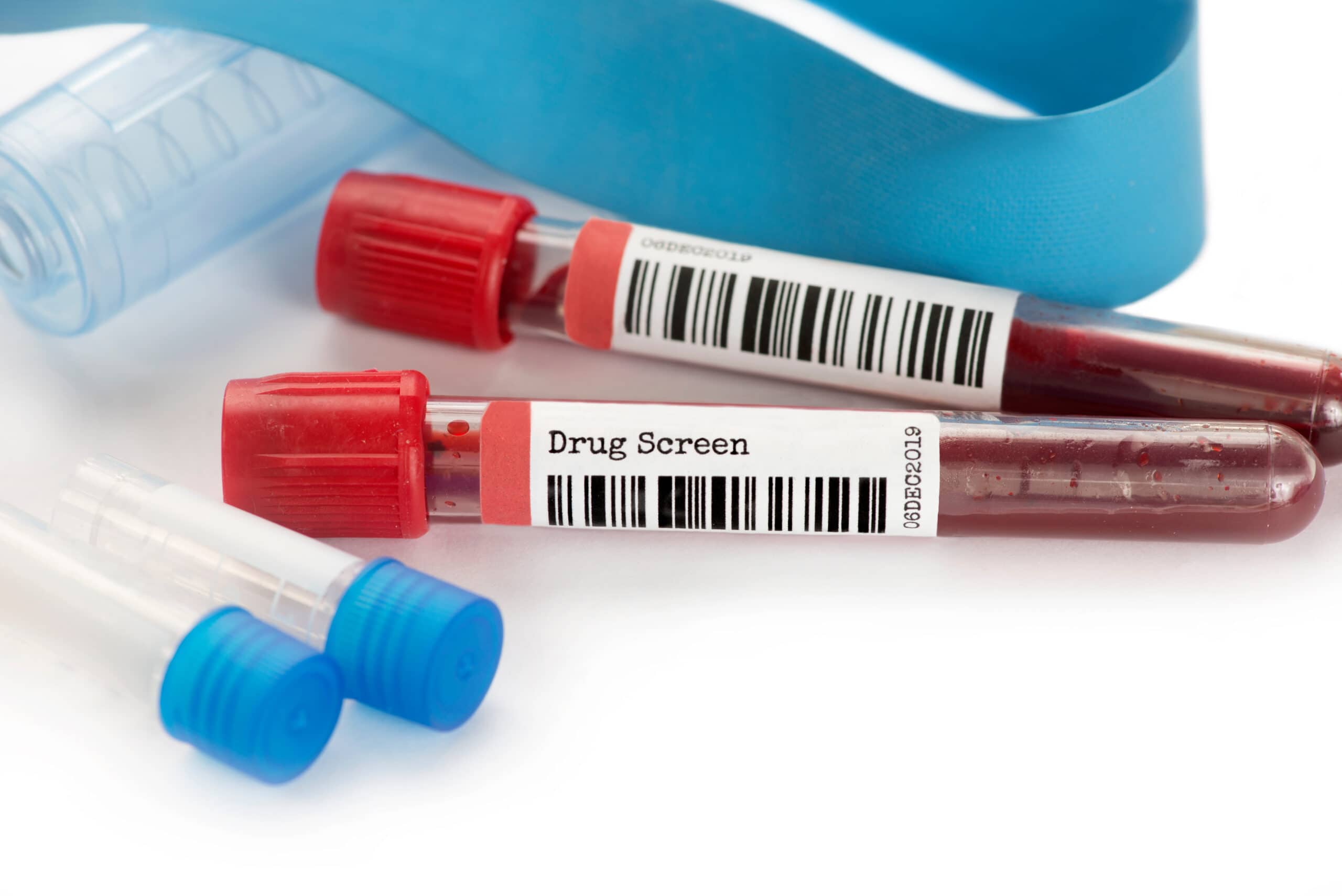 do owner operators get drug tested blood test